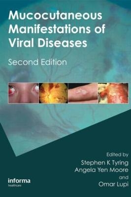 Mucocutaneous Manifestations of Viral Diseases - 