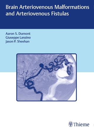 Brain Arteriovenous Malformations and Arteriovenous Fistulas