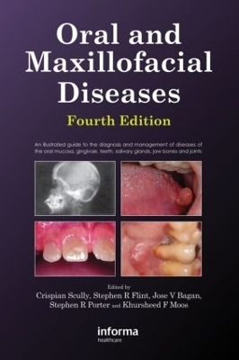 Oral and Maxillofacial Diseases - Crispian Scully, Stephen Flint, Kursheed Moos, Jose Bagan