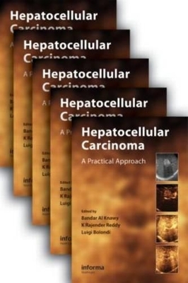 Hepatocellular Carcinoma