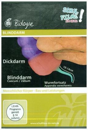 Blinddarm, 1 DVD