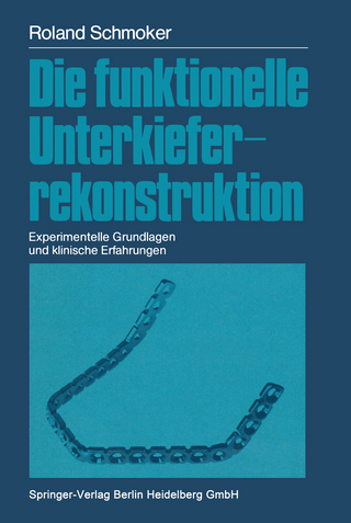 Die funktionelle Unterkieferrekonstruktion