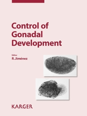 Control of Gonadal Development