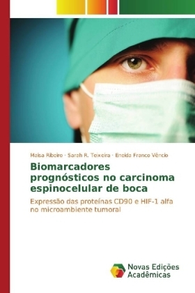 Biomarcadores prognósticos no carcinoma espinocelular de boca
