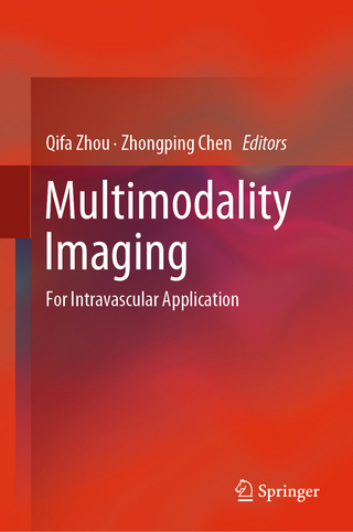 Multimodality Imaging