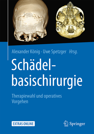 Sch&auml;delbasischirurgie