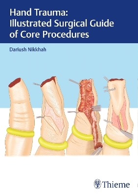 Hand Trauma: Illustrated Surgical Guide of Core Procedures - Dariush Nikkhah