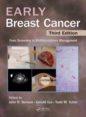 Early Breast Cancer - 