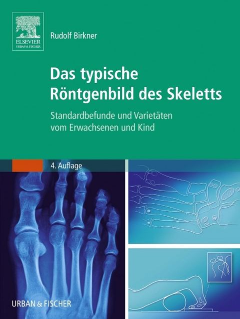 Das typische R&ouml;ntgenbild des Skeletts - Rudolf Birkner