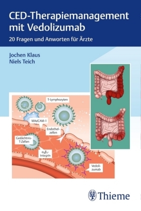 CED-Therapiemanagement mit Vedolizumab