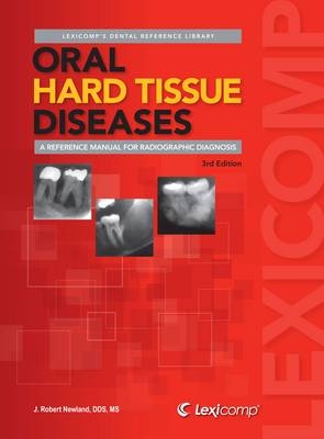 Oral Hard Tissue Diseases - J.Robert Newland