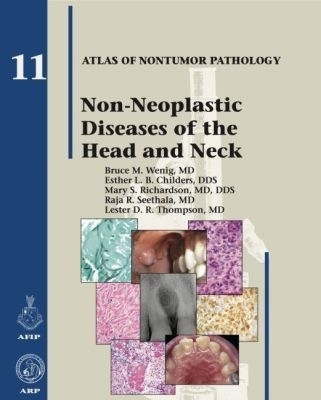 Non-Neoplastic Diseases of the Head and Neck - Bruce M. Wenig, Esther L. B. Childers, Mary S. Richardson, Raja R. Seethala, Lester D. R. Thompson