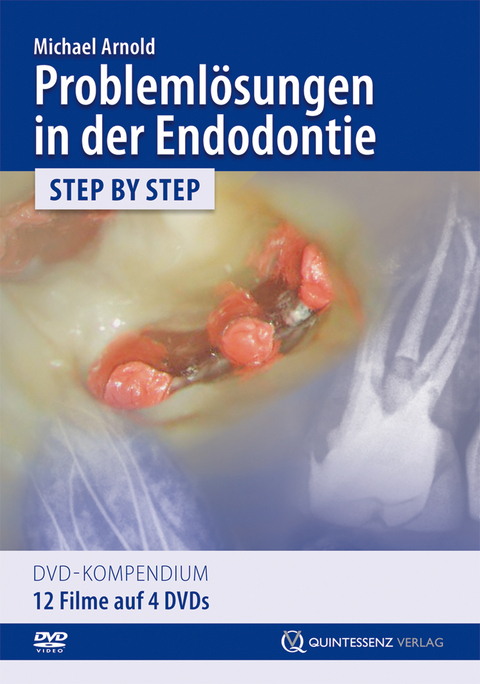 Probleml&ouml;sungen in der Endodontie - Michael Arnold