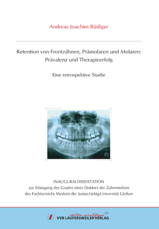 Retention von Frontzähnen, Prämolaren und Molaren: Prävalenz und Therapieerfolg