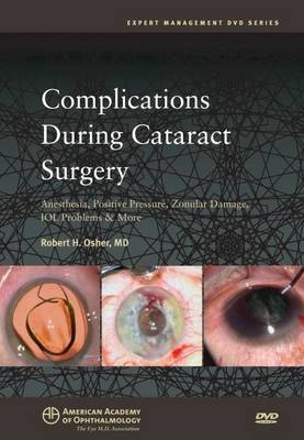 Complications During Cataract Surgery