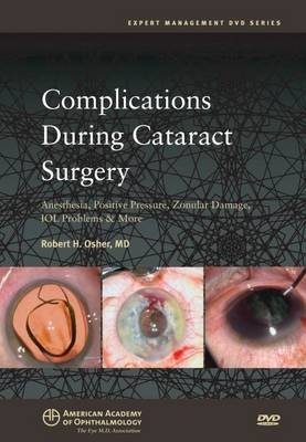 Complications During Cataract Surgery - 