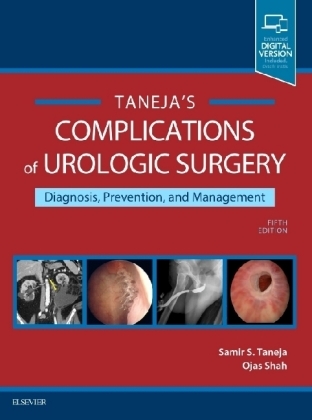 Complications of Urologic Surgery - Samir S. Taneja, Ojas Shah