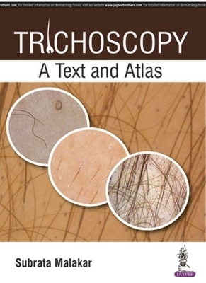 Trichoscopy
