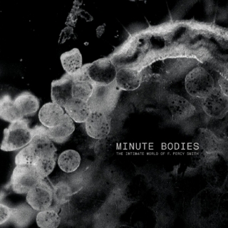 Minute Bodies, 1 Audio-CD + 1 DVD (Ltd. Deluxe Edt.)