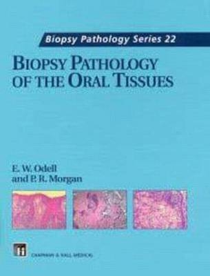 Biopsy Pathology of the Oral Tissues