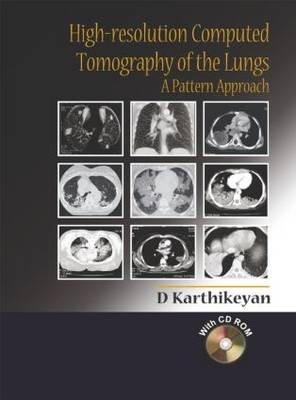 High-Resolution Computed Tomography of the Lungs: A Pattern Approach