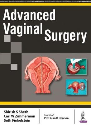 Advanced Vaginal Surgery - Shirish S Sheth, Carl W Zimmerman, Seth Finkelstein
