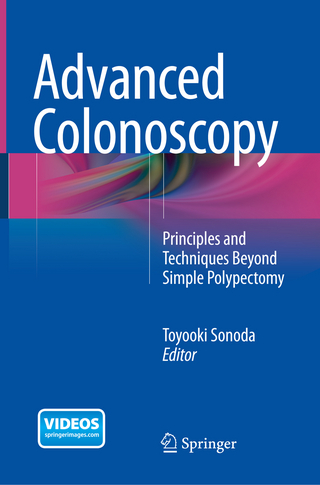 Advanced Colonoscopy
