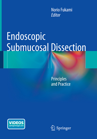 Endoscopic Submucosal Dissection