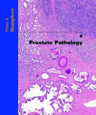 Prostate Pathology