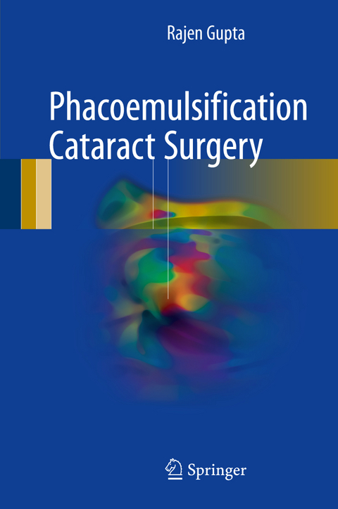 Phacoemulsification Cataract Surgery - Rajen Gupta