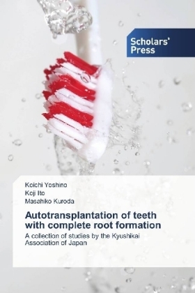 Autotransplantation of teeth with complete root formation - Koichi Yoshino, Koji Ito, Masahiko Kuroda
