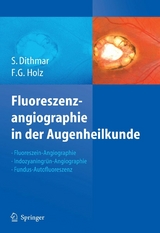Fluoreszenzangiographie in der Augenheilkunde - Stefan Dithmar, Frank G. Holz