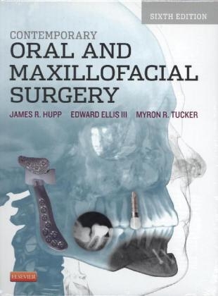 Contemporary Oral and Maxillofacial Surgery