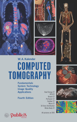 Computed Tomography - Willi A. Kalender