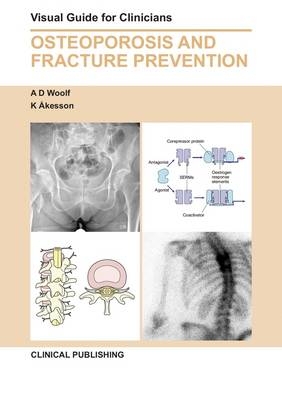 Osteoporosis and Fracture Prevention