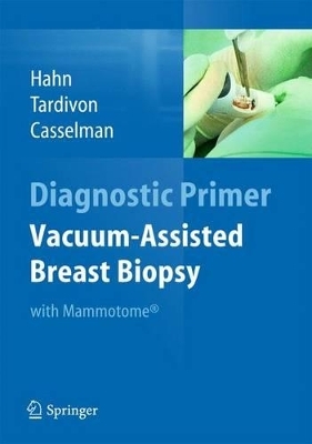 Vacuum-Assisted Breast Biopsy with Mammotome(R) - Markus Hahn, Anne Tardivon