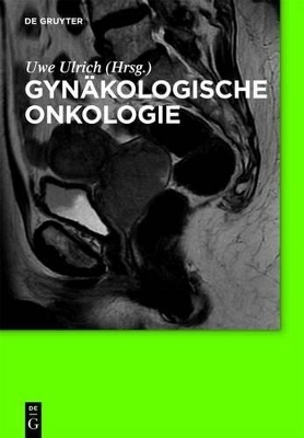 Gyn&auml;kologische Onkologie - 