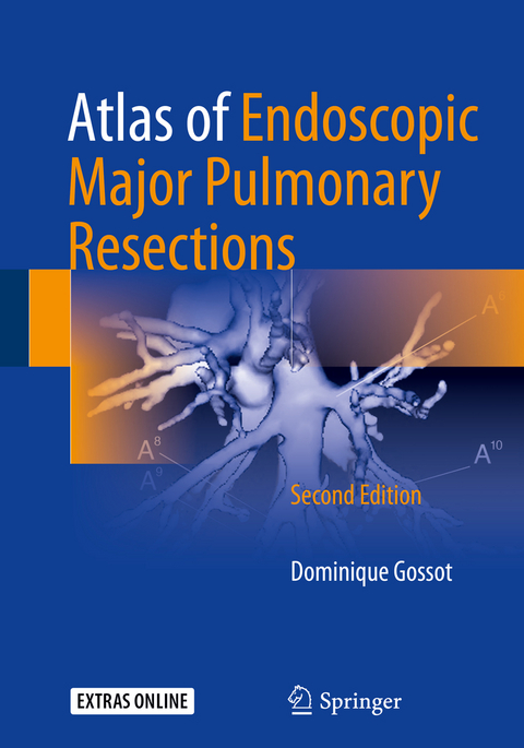 Atlas of Endoscopic Major Pulmonary Resections - Dominique Gossot