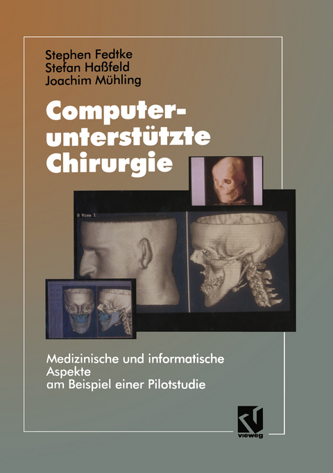 Computerunterst&uuml;tzte Chirurgie - Stephen Fedtke