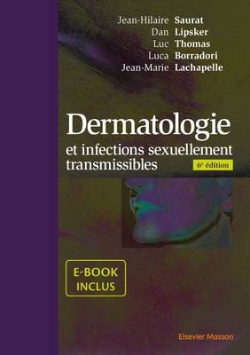 Dermatologie Et Infections Sexuellement Transmissibles