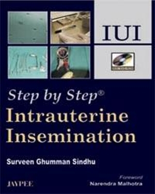 Step by Step: Intrauterine Insemination