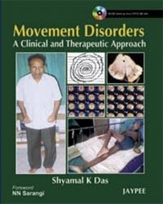 Movement Disorders