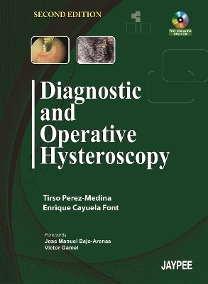 Diagnostic and Operative Hysteroscopy
