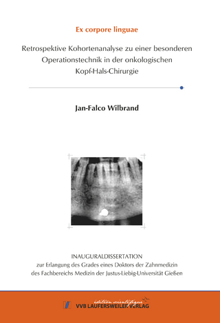 Excorpori linguae Retrospektive Kohortenanalyse zu einer besonderen Operationstechnik in der onkologischen Kopf-Hals-Chirurgie