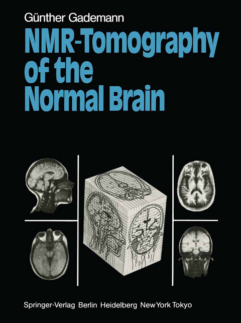 NMR-Tomography of the Normal Brain - G&uuml;nther Gademann