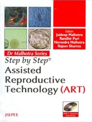 Step by Step: Assisted Reproductive Technology (ART)