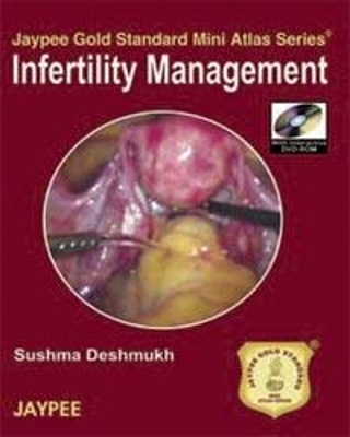 Jaypee Gold Standard Mini Atlas Series: Infertility Management