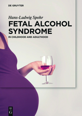 Fetal Alcohol Syndrome