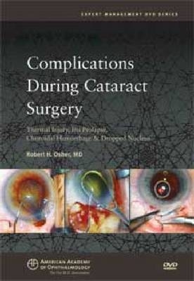 Complications During Cataract Surgery - 
