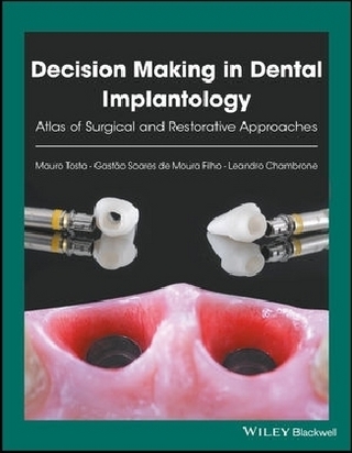 Decision Making in Dental Implantology